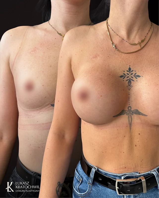 642x800_powiekszanie_2