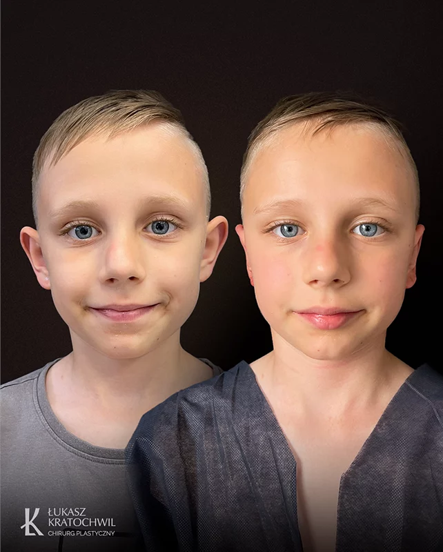 642x800_0000s_0006_uszy_2